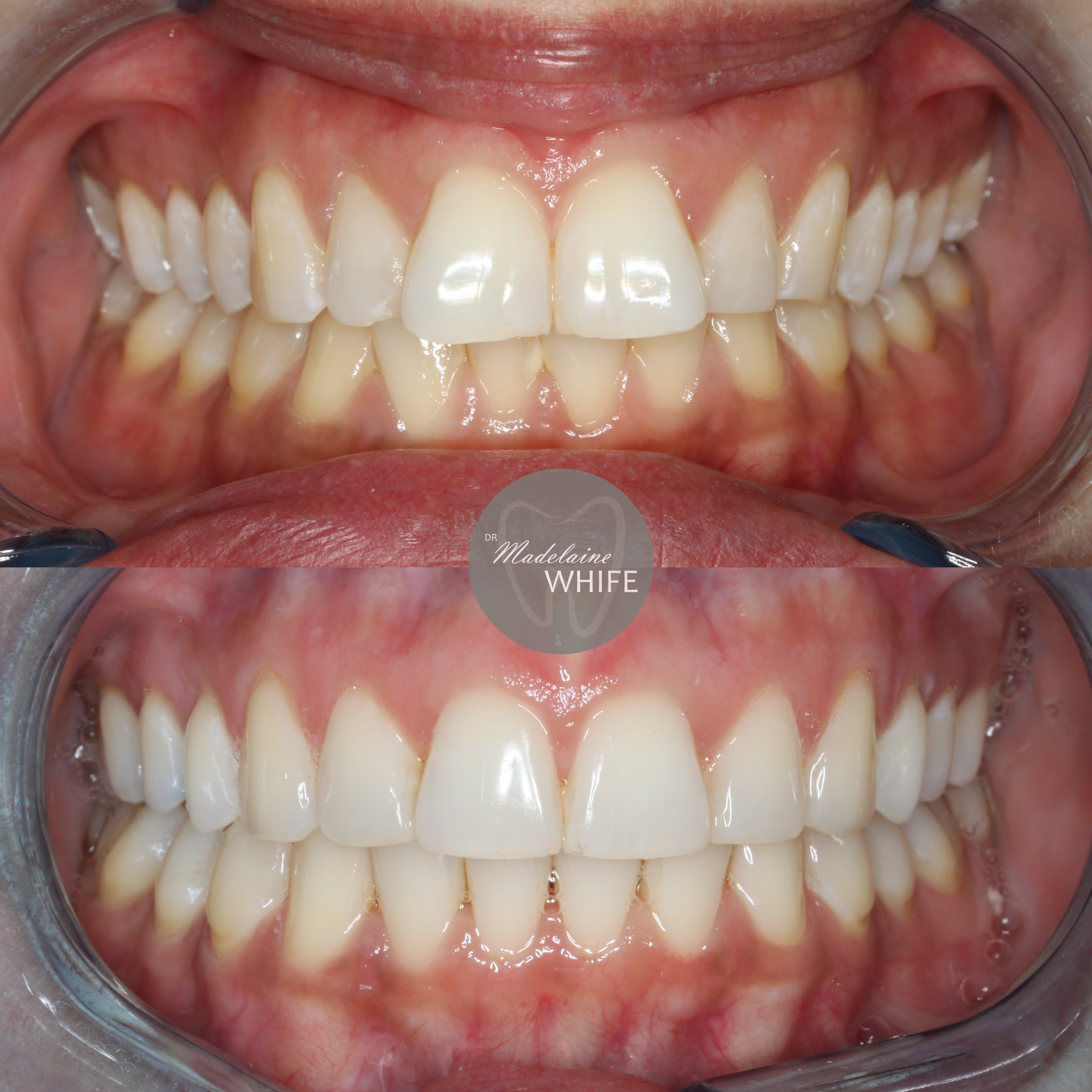 Patient 7 transformation